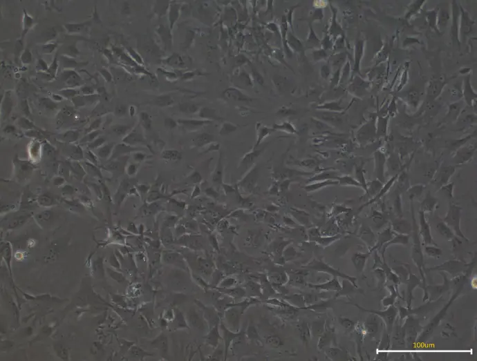 Mouse Embryonic Fibroblast Cells